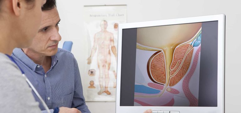Prostata a życie seksualne