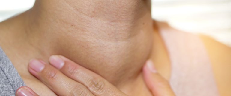 Wole tarczycy - rodzaje, objawy i leczenie