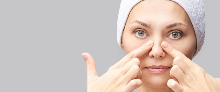 Polipy w nosie i zatokach przynosowych