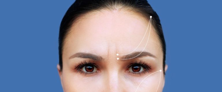 Lifting czoła i podniesienie brwi