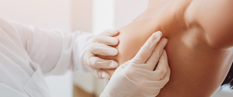 Zmniejszenie piersi poprzez operację plastyczną - o zabiegu redukcji biustu