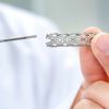 Stenty – rodzaje, zastosowanie, przebieg zabiegu i tryb życia po implantacji stentów