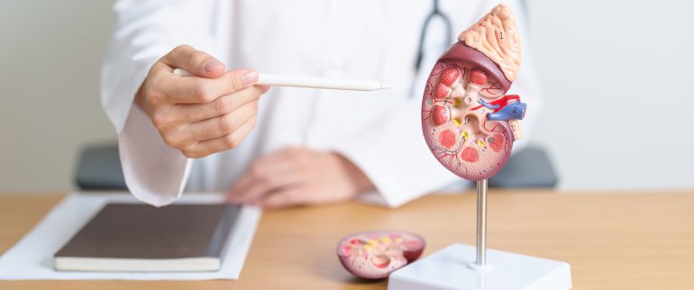 Kamica nerkowa – objawy, diagnostyka i metody leczenia