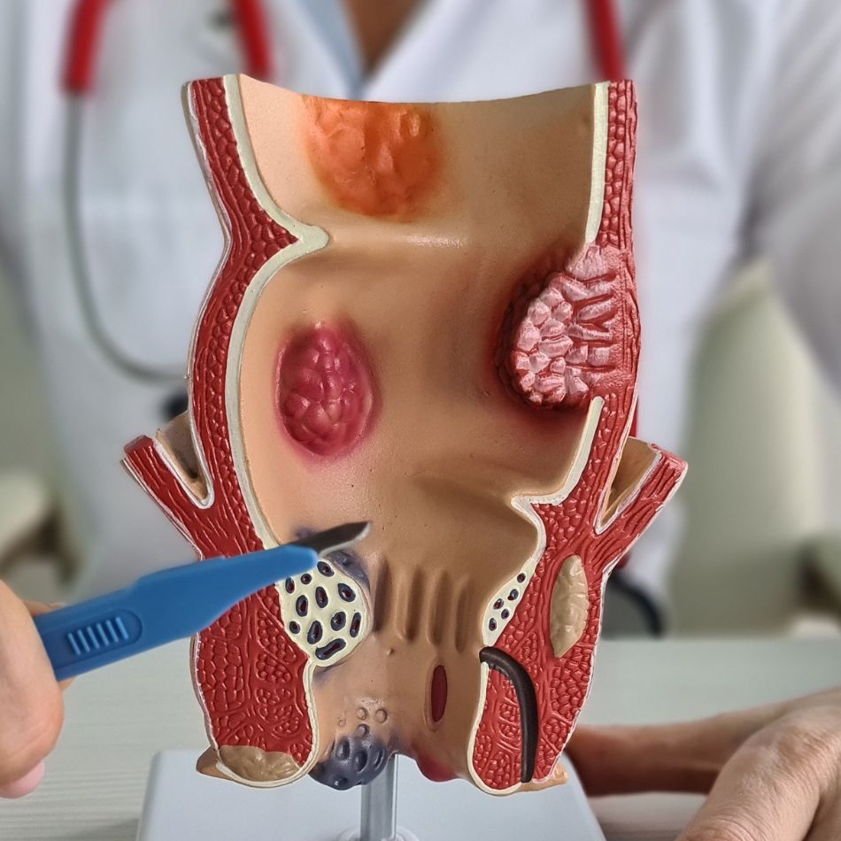 proktolog-krakow-scm