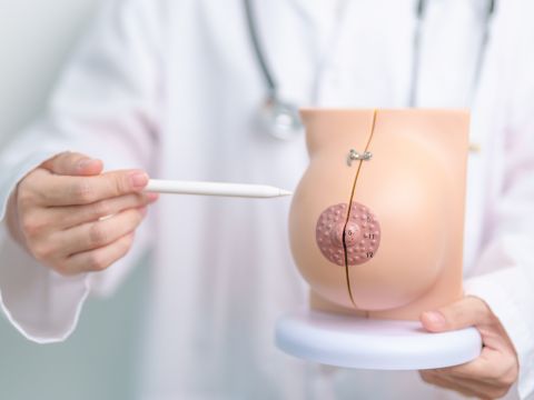 rekonstrukcja-brodawki-otoczki-sutkowej-scm-krakow