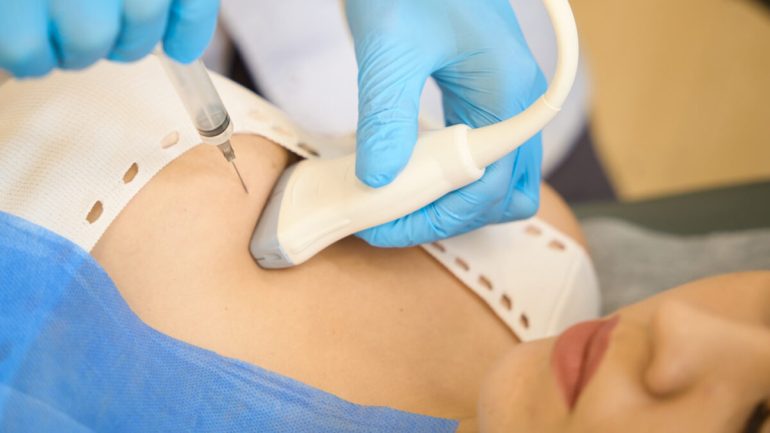 biopsja-cienkoiglowa-piersi-gruboiglowa-piersi-krakow-scm