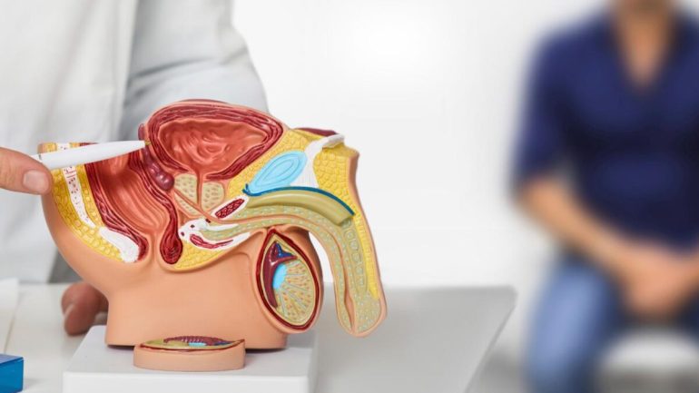 rak-prostaty-objawy-krakow-scm
